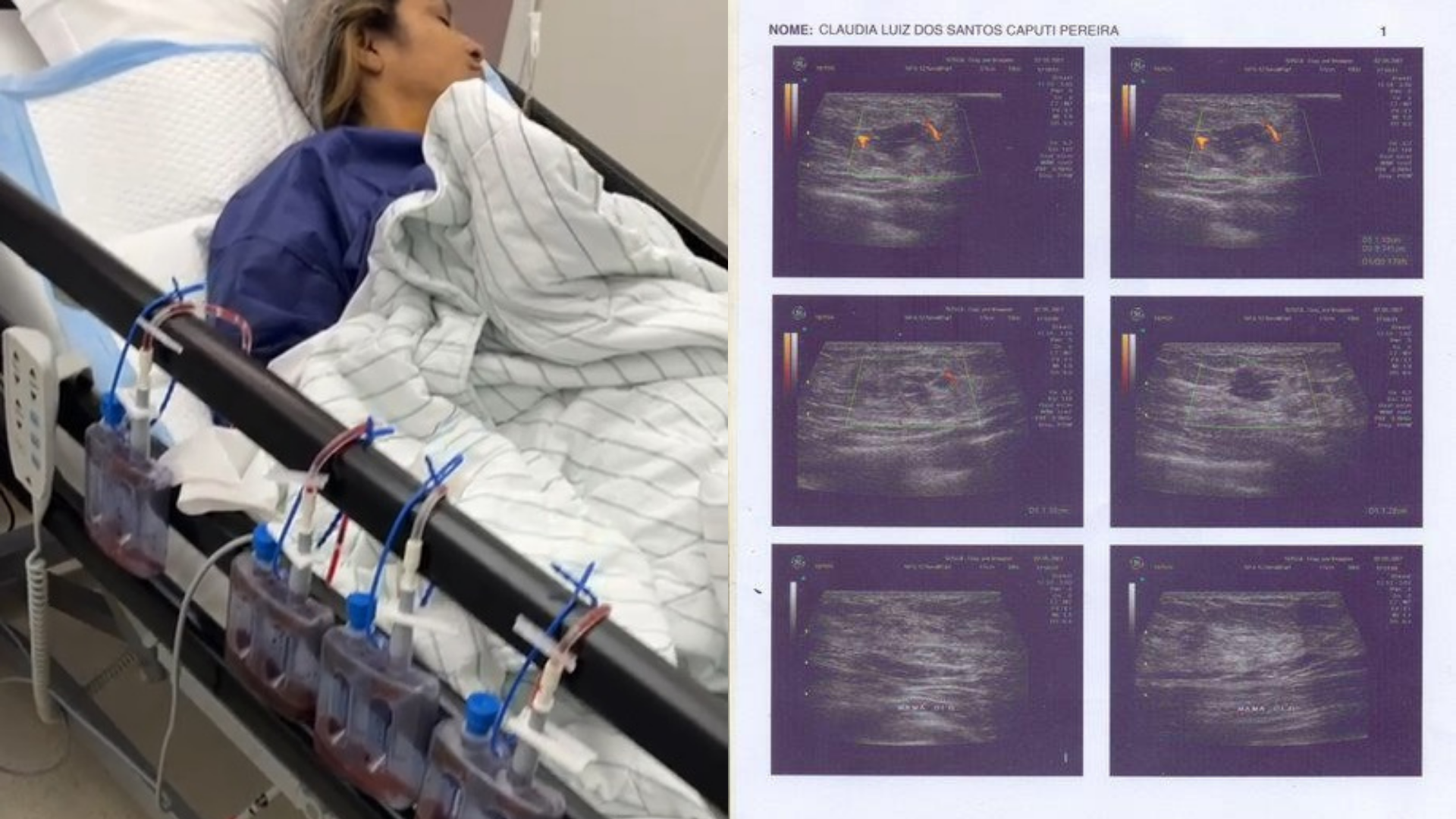 Jornalista testemunha cura de câncer de mama: “Nossa fé em Deus é primordial”